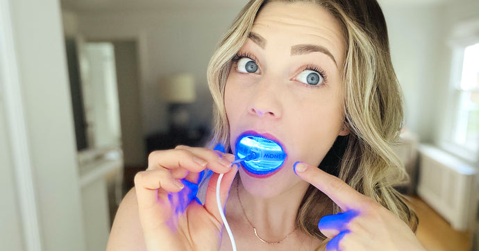 Our Top 5 Picks For The Best Teeth Whitening Kit (Starting Under $20)